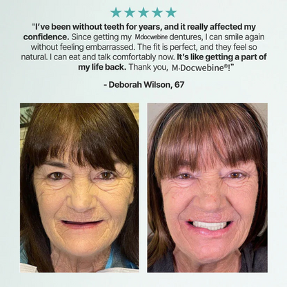 📜Only Trust Official🏛️ M·Docwebine® Medical Full Denture with Strong Suctiond🦷Obtain American Dental Association (ADA) Certification - 🌎Ends Today: 70% OFF!
