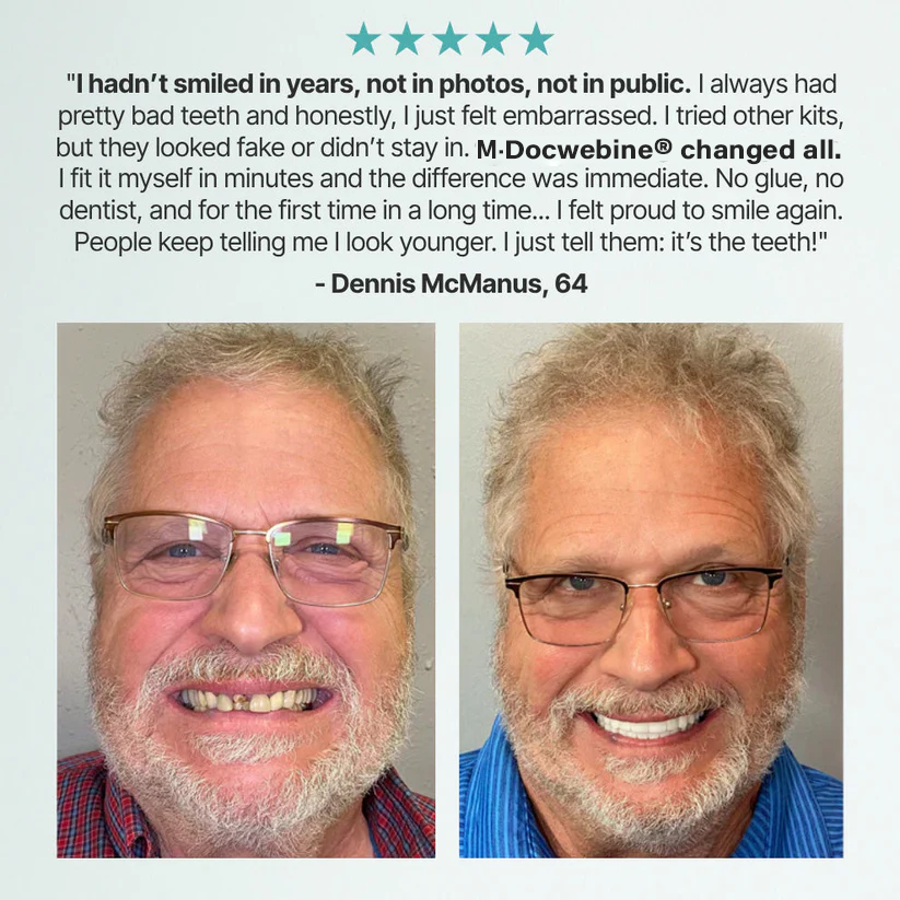 📜Only Trust Official🏛️ M·Docwebine® Medical Full Denture with Strong Suctiond🦷Obtain American Dental Association (ADA) Certification - 🌎Ends Today: 70% OFF!