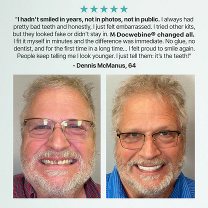 📜Only Trust Official🏛️ M·Docwebine® Medical Full Denture with Strong Suctiond🦷Obtain American Dental Association (ADA) Certification - 🌎Ends Today: 70% OFF!