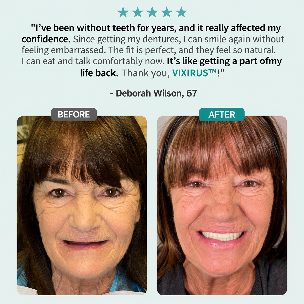 📜Only Trust Official🏛️ VIXIRUS® Medical Full Denture with Strong Suctiond🦷Obtain American Dental Association (ADA) Certification - 🌎Ends Today: 70% OFF!